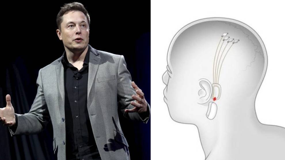 Conecta tu cerebro a un ordenador: Elon Musk muestra los avances en Neuralink con un “un Fitbit en el cráneo”