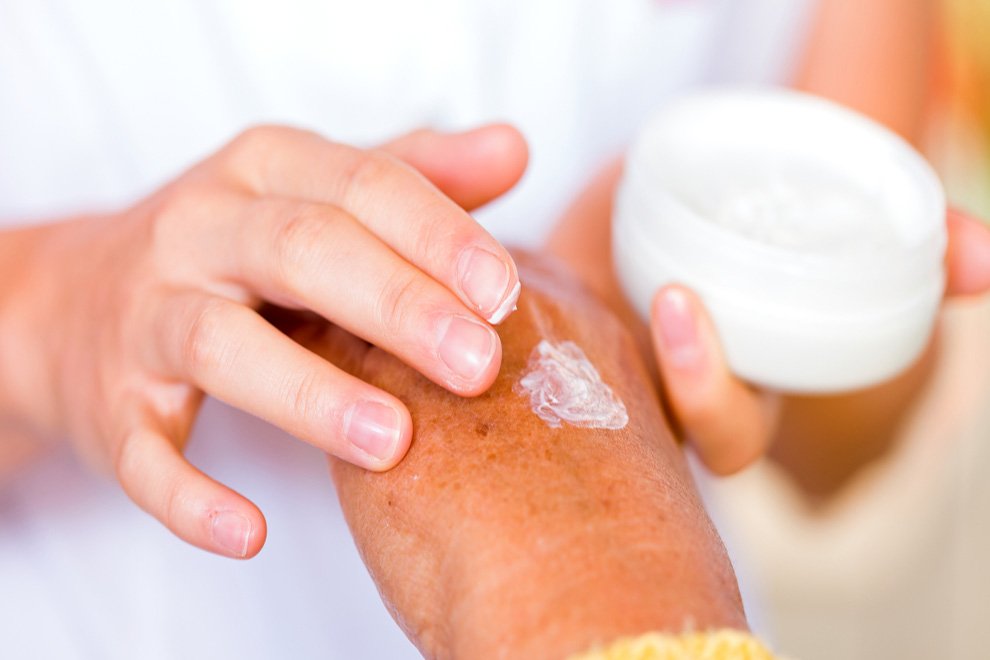 Melanoma Monday crea conciencia sobre el cáncer de piel
