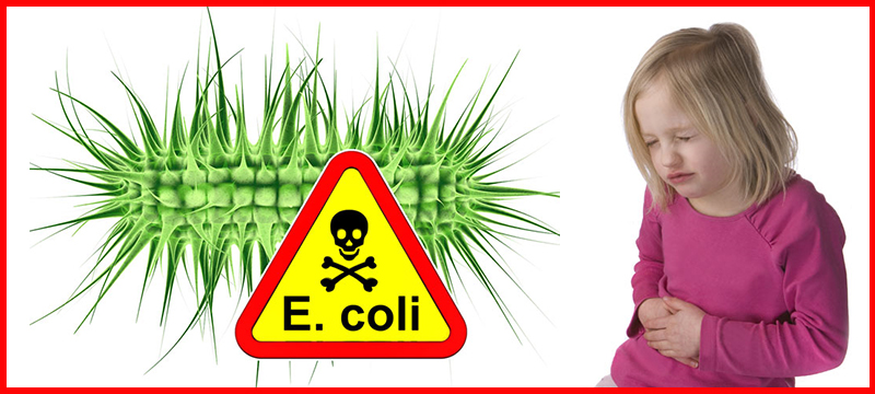 Alertan sobre brote de E.coli vinculado a la carne molida de res en todo EE. UU.