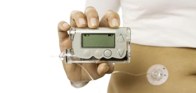 Avances tecnológicos para convivir con la diabetes