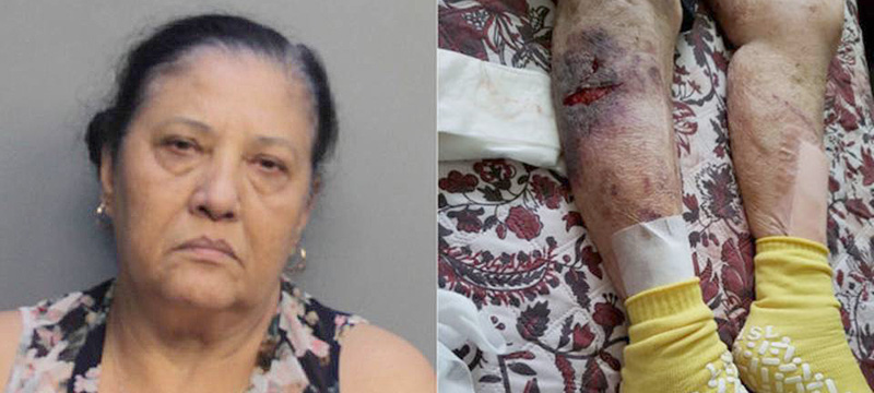 Cuidadora de anciana a la cárcel por agresión agravada