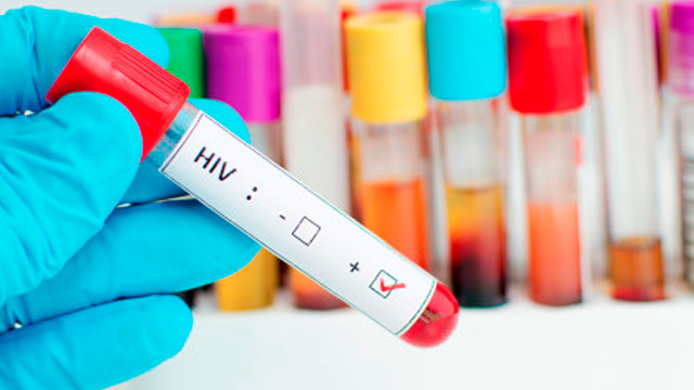 El último avance de la ciencia: células madres para tratar el VIH