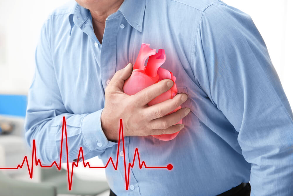 Estudio revela que en Nochebuena aumenta el riesgo de sufrir un infarto