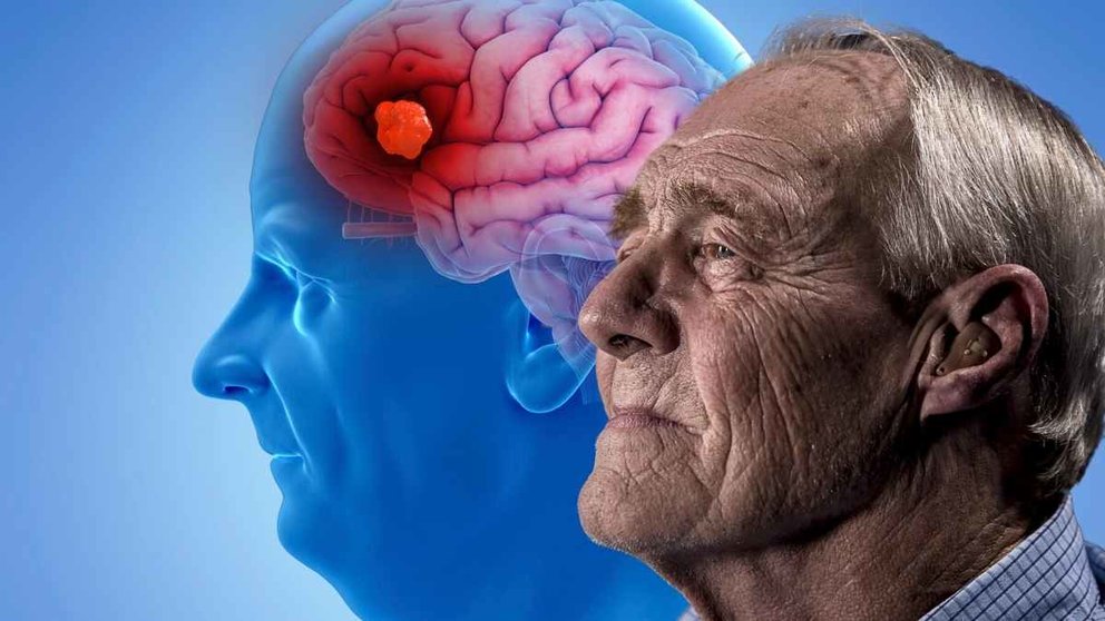 Descubren proteína que recupera la memoria, solución para el alzheimer