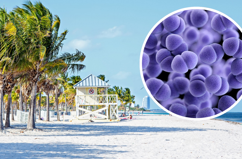 Alerta sanitaria en Key Biscayne: detectan altos niveles de bacteria fecal en playa de Crandon Park