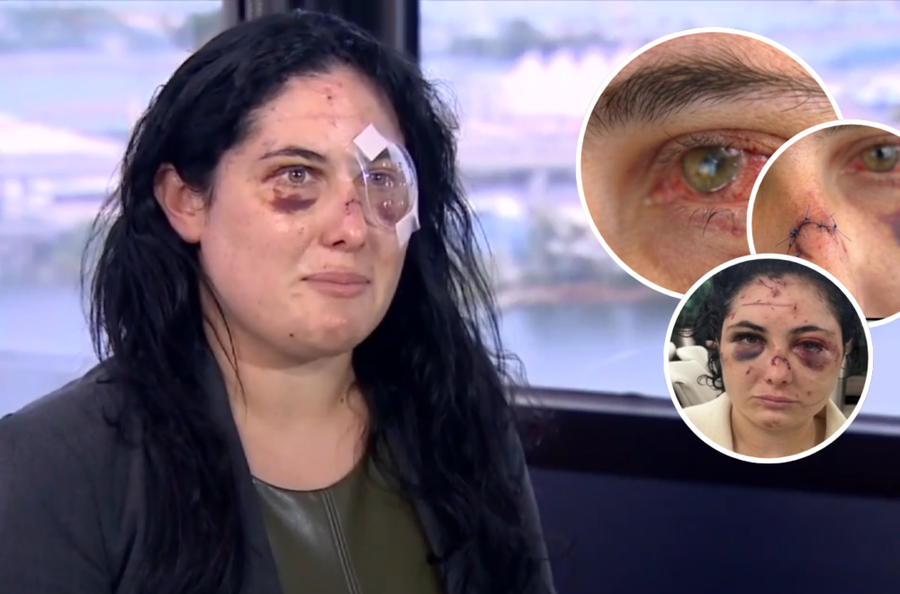 Mujer apuñalada con bolígrafo en Downtown Miami quedó parcialmente ciega