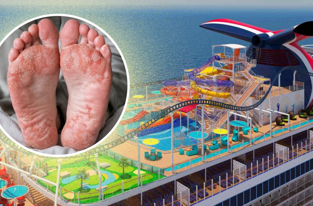 Pasajero demanda a Carnival por $5 millones tras quemarse los pies en un crucero
