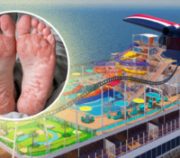 Pasajero demanda a Carnival por $5 millones tras quemarse los pies en un crucero