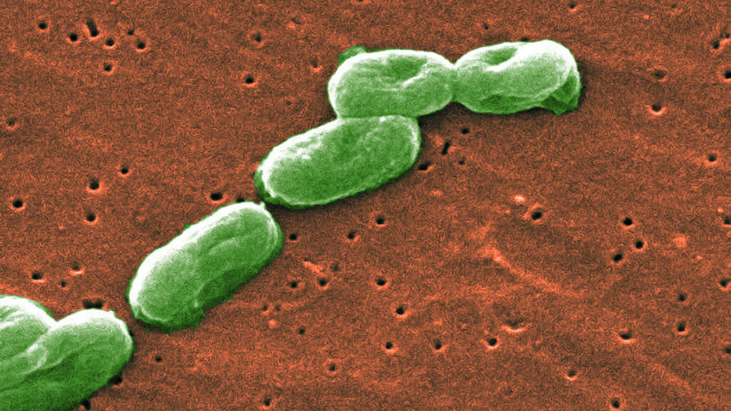 Bacteria Burkholderia toallitas húmedas Target