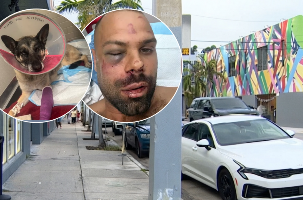 Hombre termina con el rostro fracturado tras brutal ataque de dos pitbulls en Wynwood