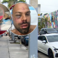 Hombre termina con el rostro fracturado tras brutal ataque con dos pitbulls en Wynwood