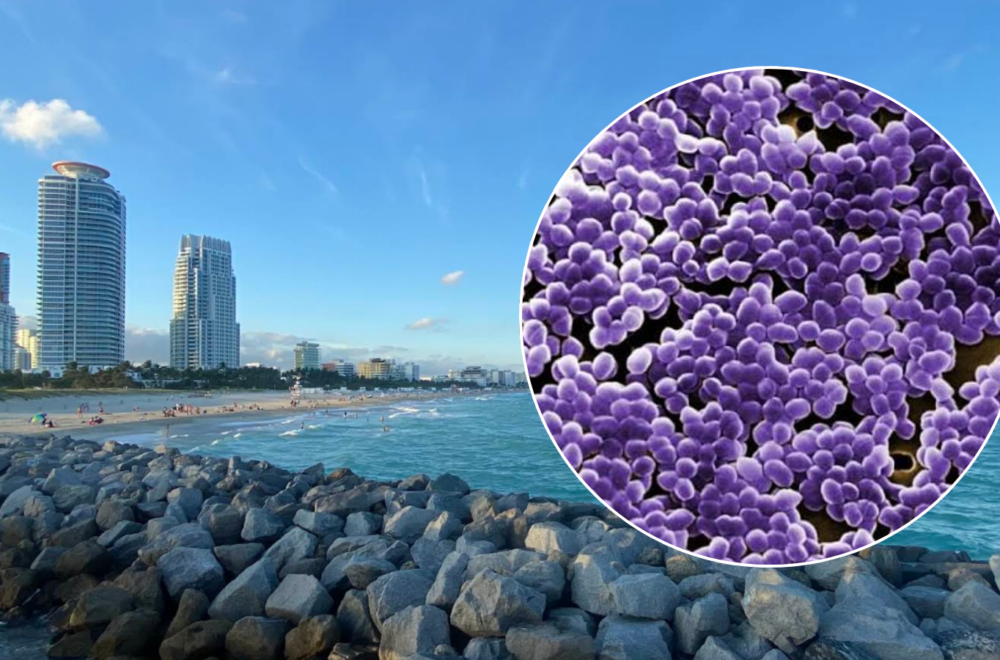 Alerta sanitaria: tres playas de Miami-Dade están contaminadas con bacterias fecales