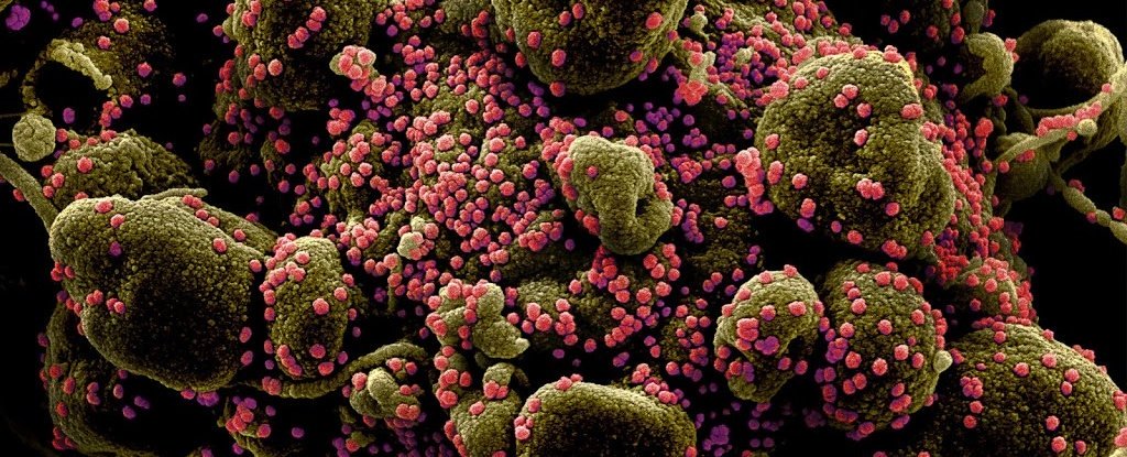 Virólogo explicó lo que provoca el coronavirus en el cuerpo que lo hace tan mortal