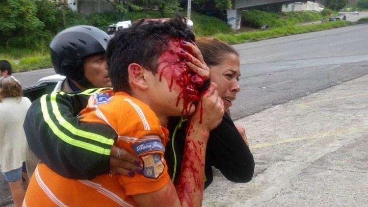 Policías venezolanos que mutilaron el rostro del joven en el Táchira fueron arrestados