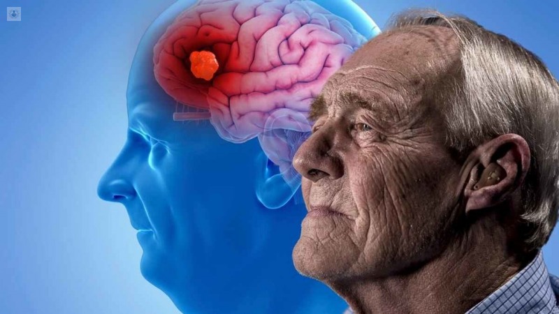 Estudian combinación de fármacos para tratar con éxito el Alzheimer