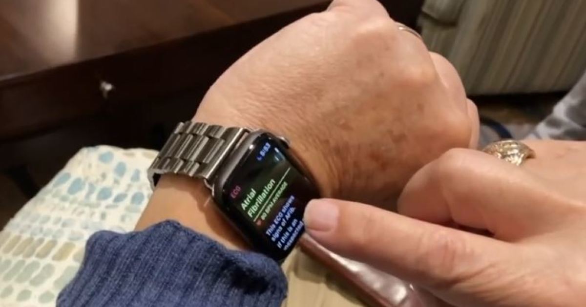 Hombre del Florida asegura que Apple Watch le salvó la vida