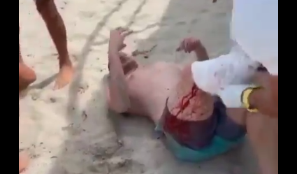 En vídeo: Sujeto fue atacado por un tiburón en Miami Beach
