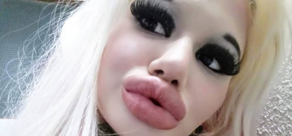 ¿Los labios más grandes del mundo? La estudiante búlgara que quiso ser una barbie y ahora va por otra meta +Fotos