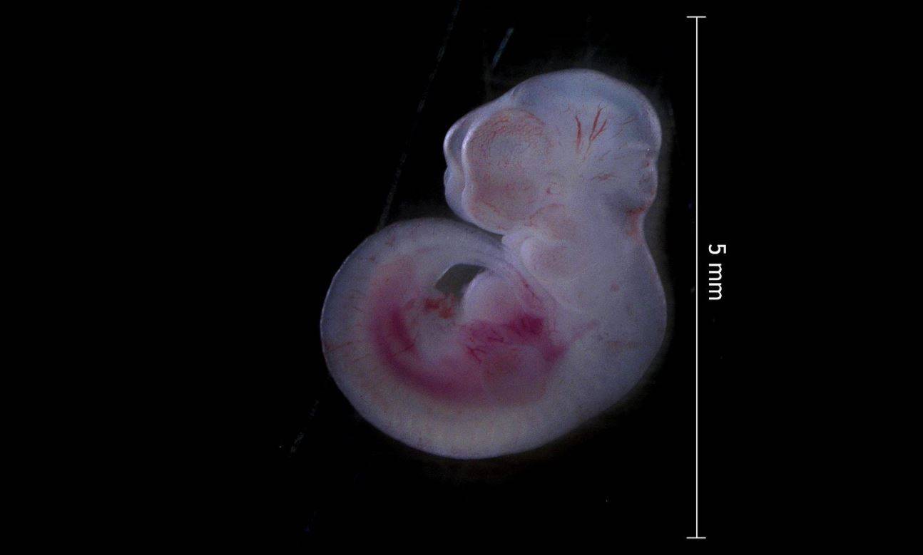 Científicos logran crear un embrión ‘sintético’ con cerebro y corazón en su fase inicial