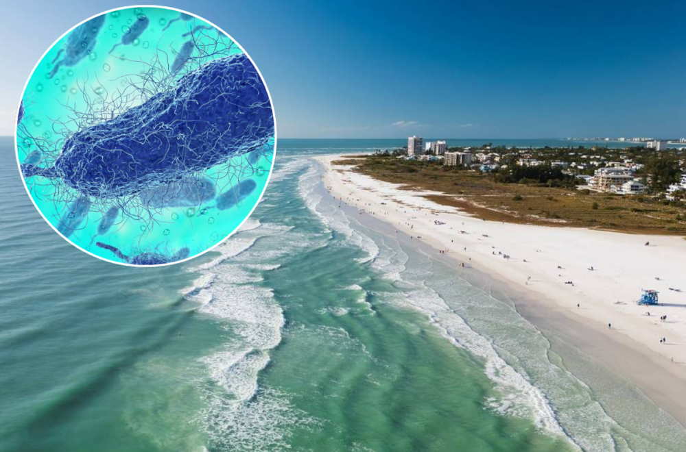 Autoridades confirman 4 muertes por bacteria “come carne” en Florida