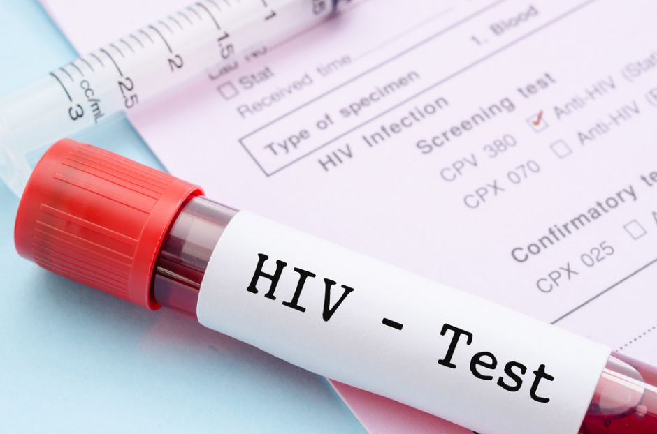 Nuevo subtipo de VIH fue descubierto