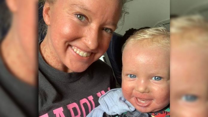 Bajaron de avión de American Airlines a madre y su bebé por rara enfermedad en la piel