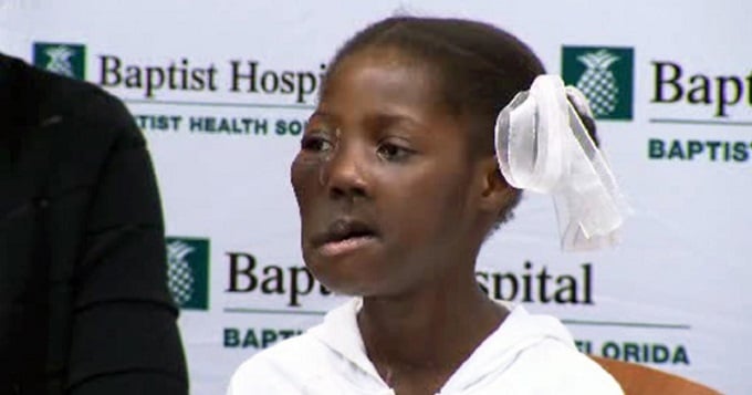 Mujer haitiana que le extirparon un tumor en la cara regresó a Miami