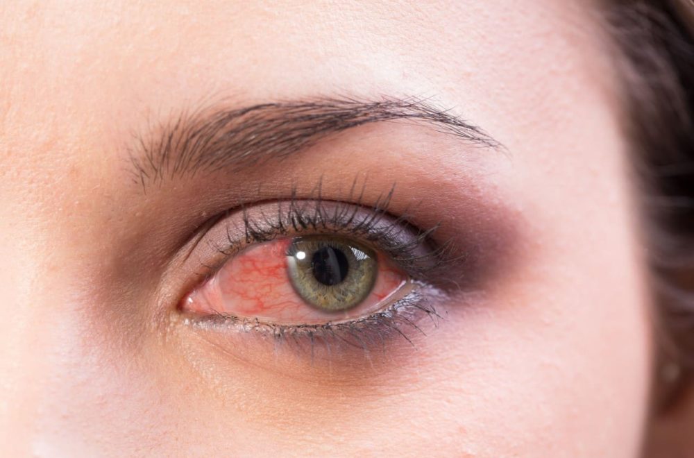 FDA insta a desechar gotas para los ojos infectadas con bacterias y hongos