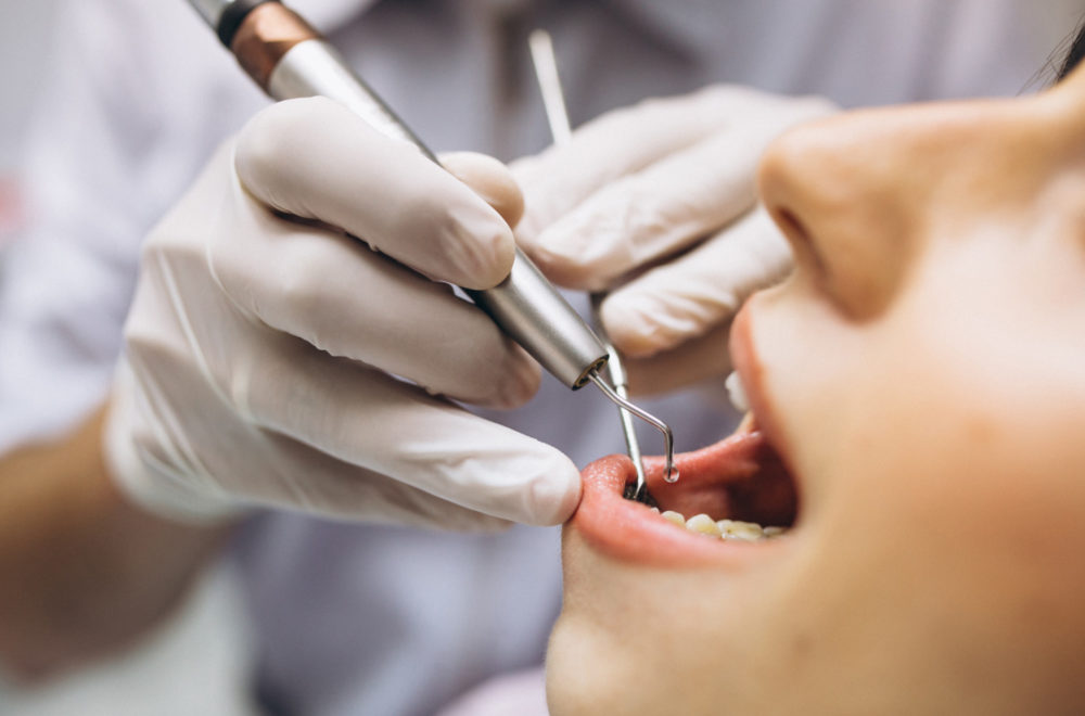 Tipos de Seguros Dentales: DPPO, DHMO