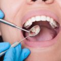 Dentista: cómo evitar arruinarse tras una demanda por negligencia