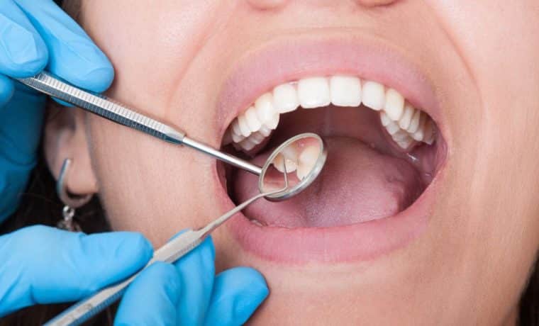 Dentista: cómo evitar arruinarse tras una demanda por negligencia