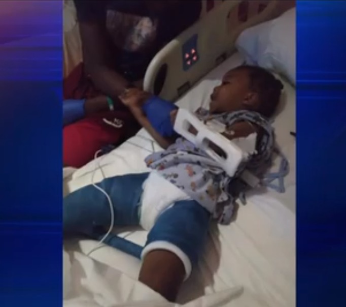 Familia de Broward acusa a una guardería por fracturar la pierna de su hijo