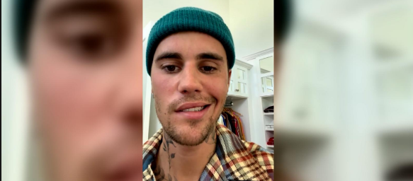 Justin Bieber muestra primeros signos de recuperación tras su parálisis facial
