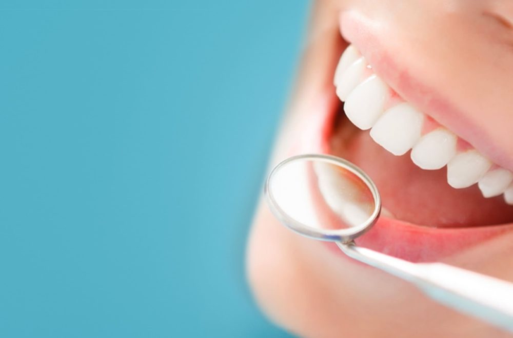 PPO o HMO ¿cuál de los dos seguros dentales escojo?