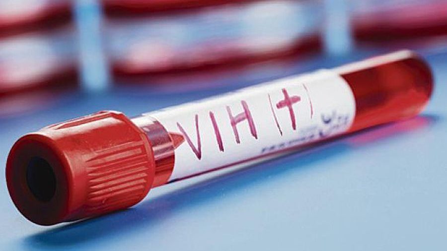 Florida tiene la cifra más alta de casos de VIH en EEUU
