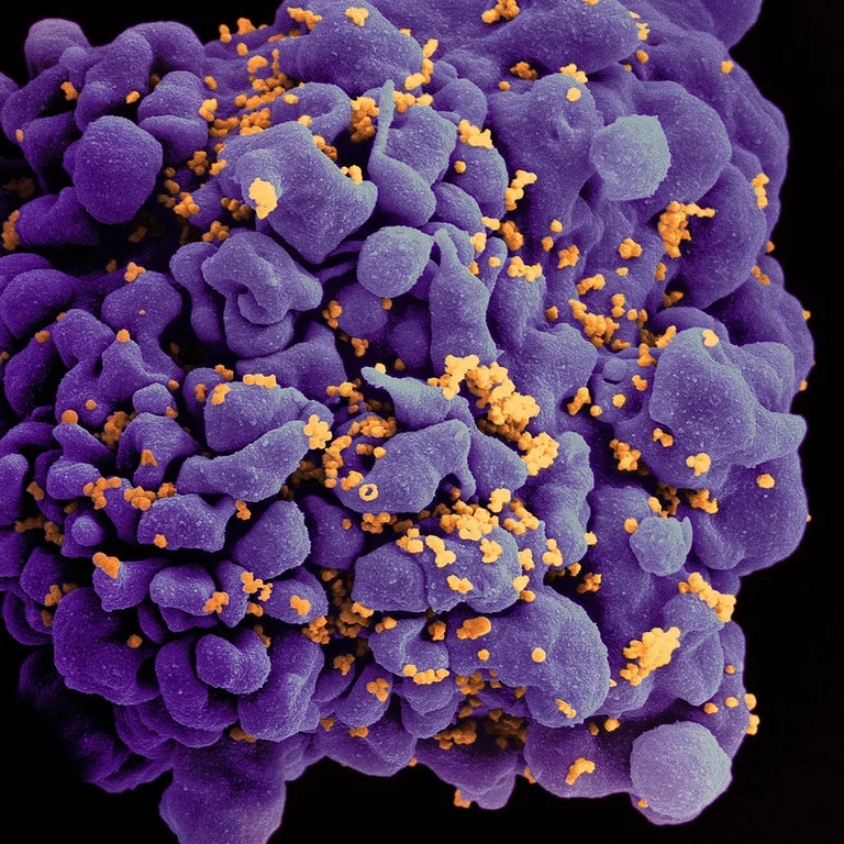 Científicos descubren mecanismo que regula al VIH latente en los pacientes