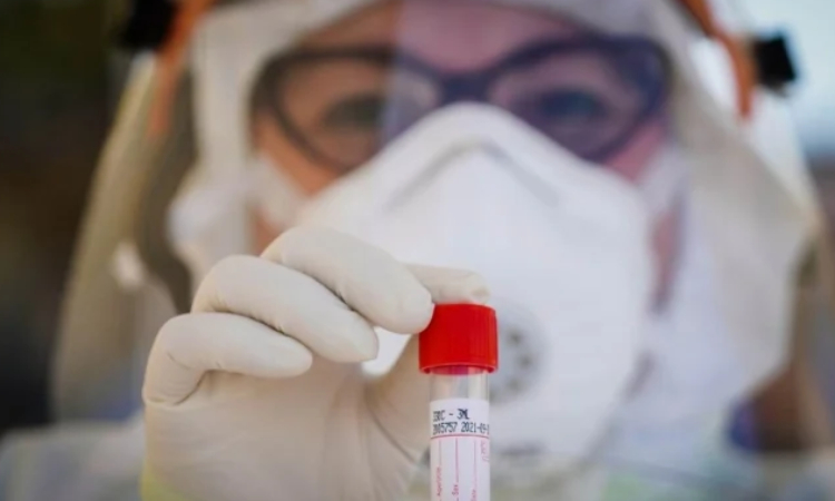 Científicos de la Universidad de Oxford tendrían lista en septiembre vacuna contra coronavirus