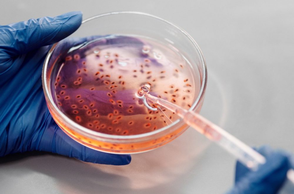 Aumentan muertes por bacteria carnívora en EE.UU: ¿Cómo evitar la infección?