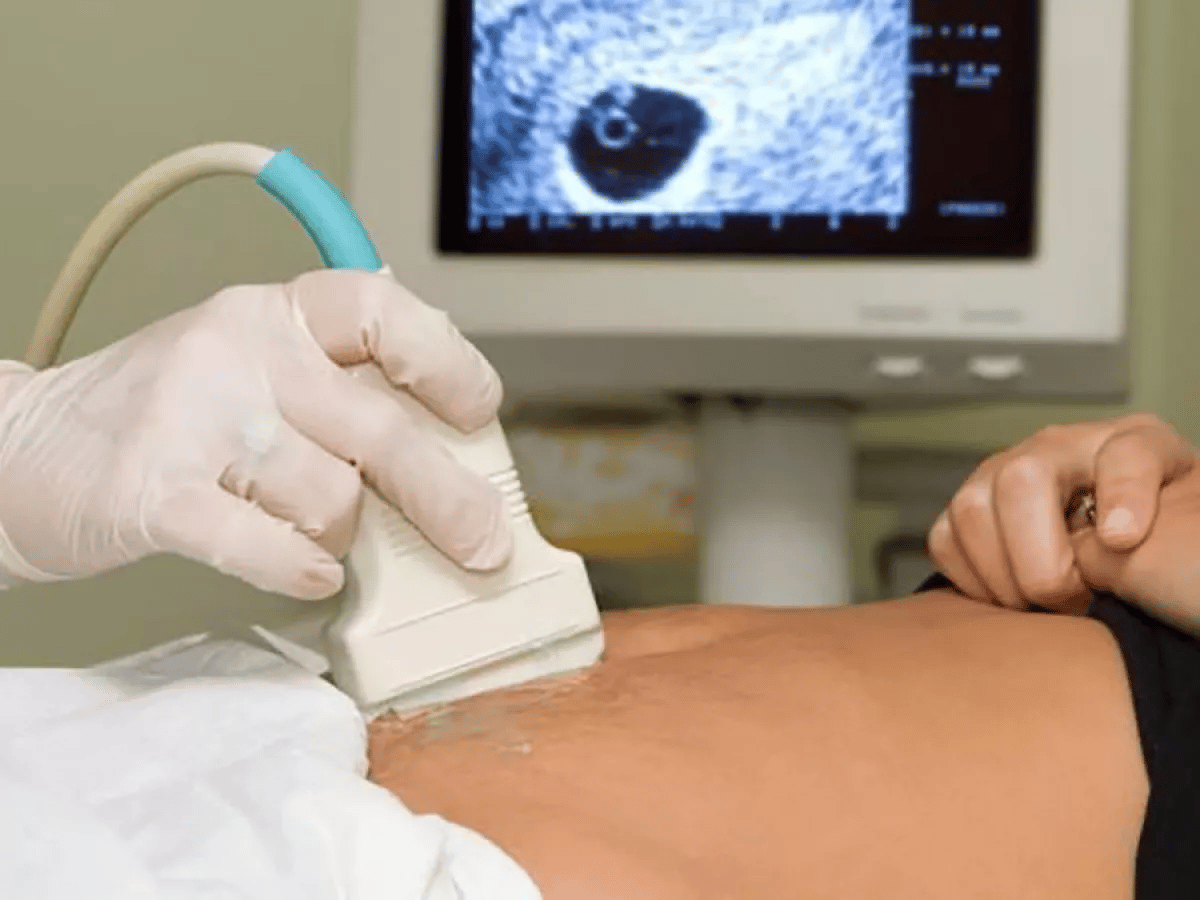Complicaciones que ameritarían un aborto limitadas en algunos estados