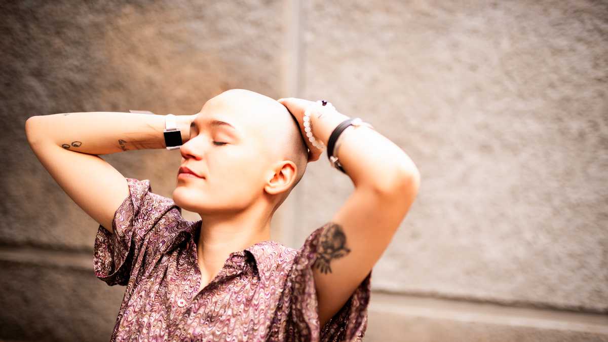 ¿Qué es la alopecia y como se trata?