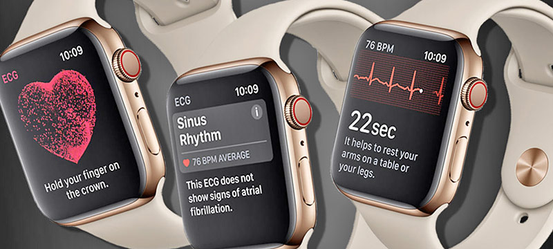 Apple Watch monitorea y alerta sobre problemas cardíacos