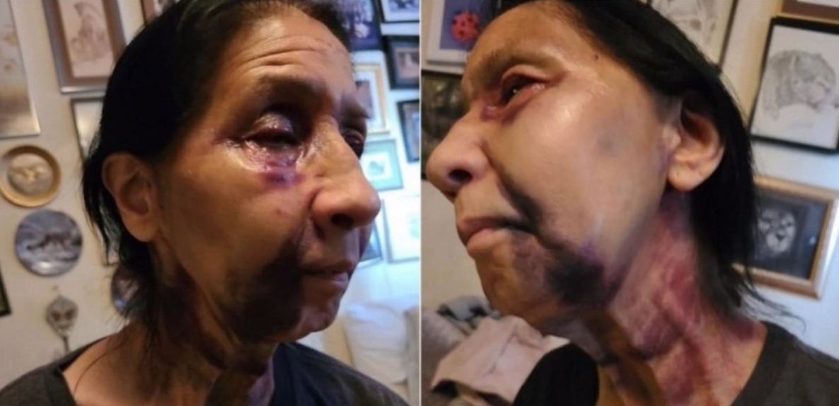 Anciana mexicana fue agredida al ser confundida con asiática en L.A.