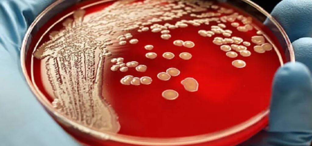 ¡Alerta! Infectados por bacteria ‘come carne’ y ameba ‘come cerebro’ tras nadar en Florida corren serio peligro