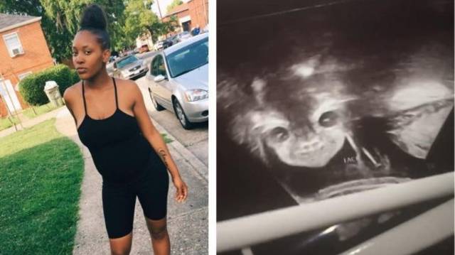 Al ver ecosonograma mujer embarazada asegura que su hija es un “bebé demonio”