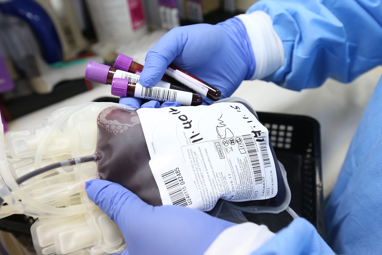 Autoridades de Hialeah piden donar plasma para ayudar a quienes contraigan el coronavirus
