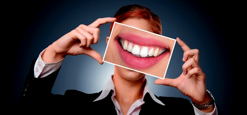 La mujer con “la boca más grande del mundo” causa furor en las redes