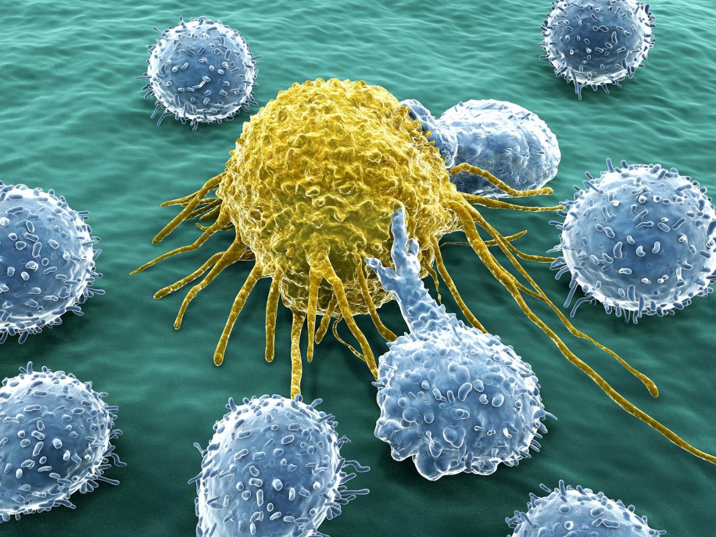 Alimentación podría determinar el destino de algunas células cancerosas