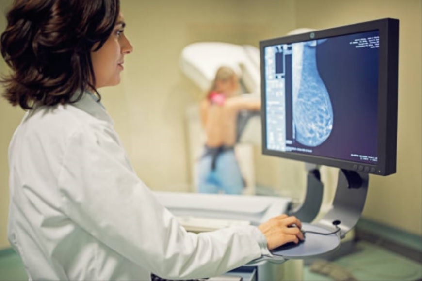 Cáncer de Mama: organizan jornadas de mamografías gratis en Miami