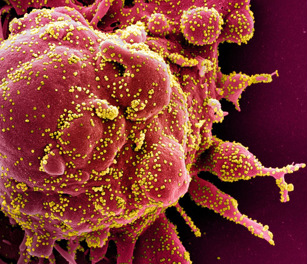 Investigadores de Florida detectaron que una mutación vuelve más infeccioso al coronavirus