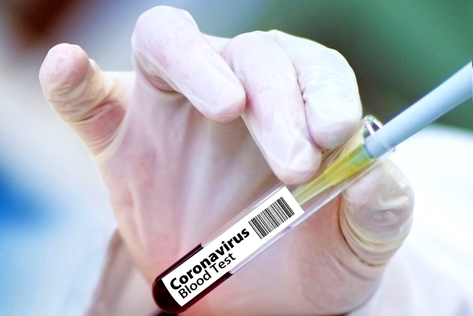 Lo que debe saber sobre la vacuna del Covid-19